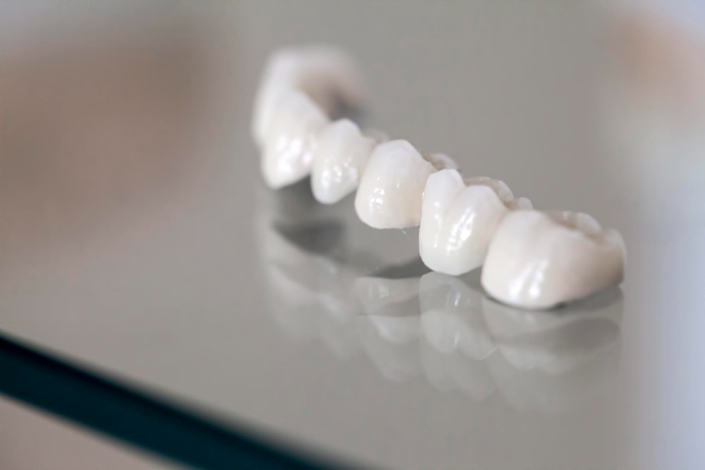 Porcelain Crowns  San Diego, CA